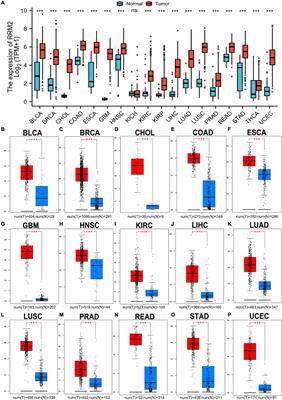 High expression of RRM2 mediated by non-coding RNAs correlates with poor prognosis and tumor immune infiltration of hepatocellular carcinoma
